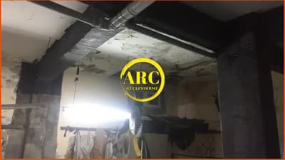 Karbon Fiber Kolon Güçlendirme Maliyeti & Faydaları